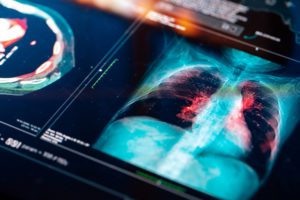 Medical Imaging displaying a chest scan of a patient.