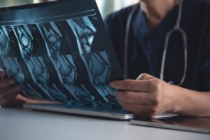 Doctor holding and looking patient bone x-ray film before surgery