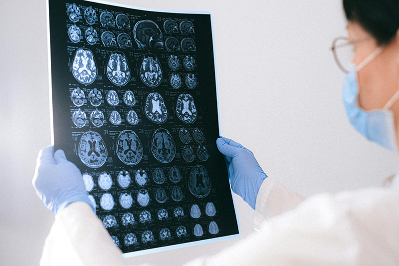 What treatments are available for your brain health? While there’s currently no cure, treatments can help manage symptoms.